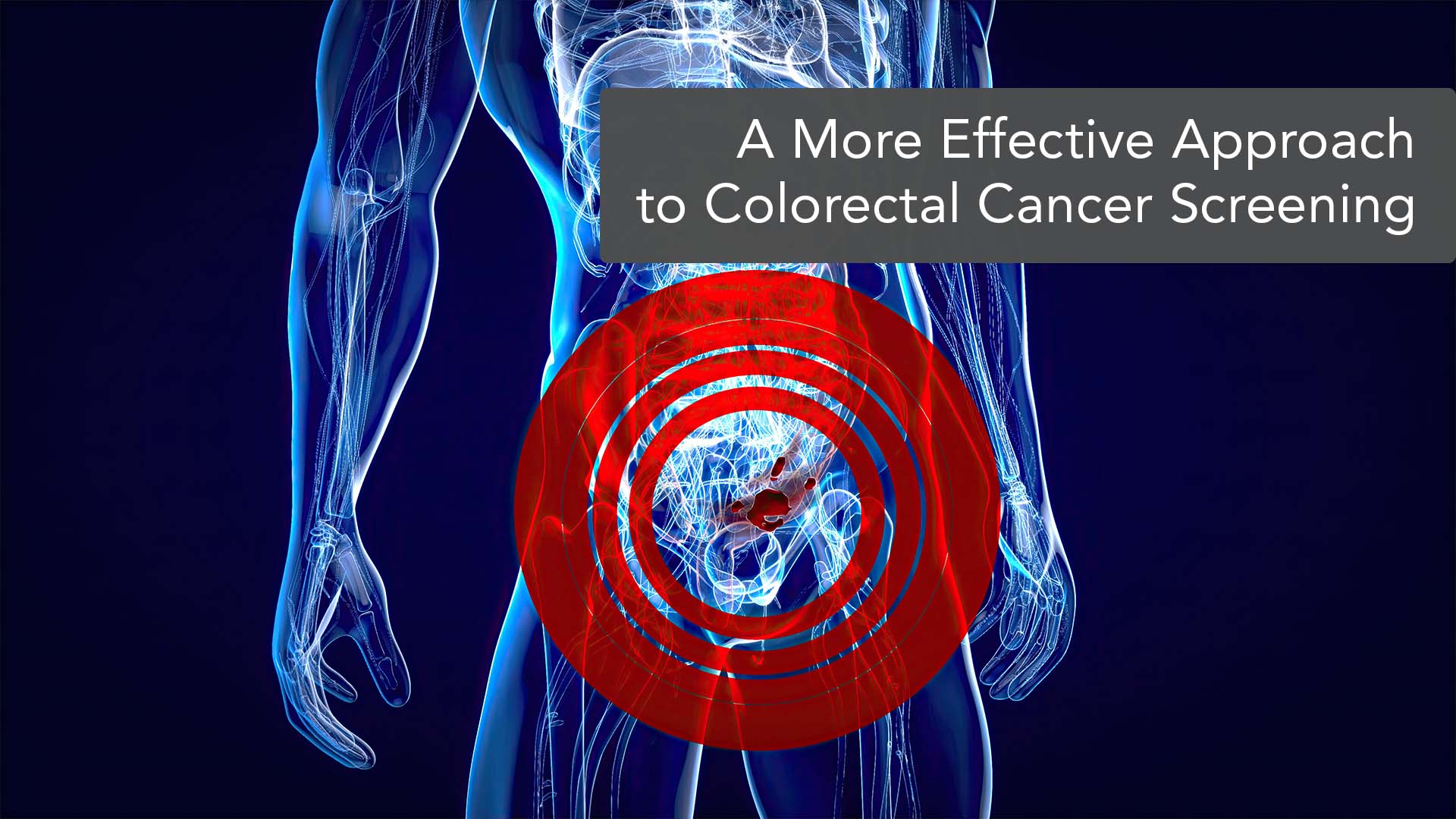 A more effective approach to Colorectal Cancer Screening
